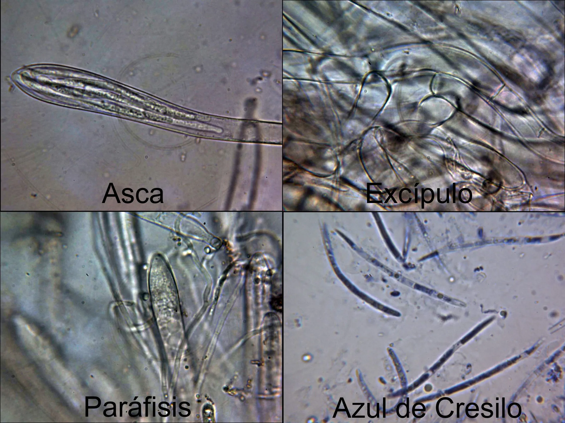 Microscopía de Spathularia flavida - 13 -  micro